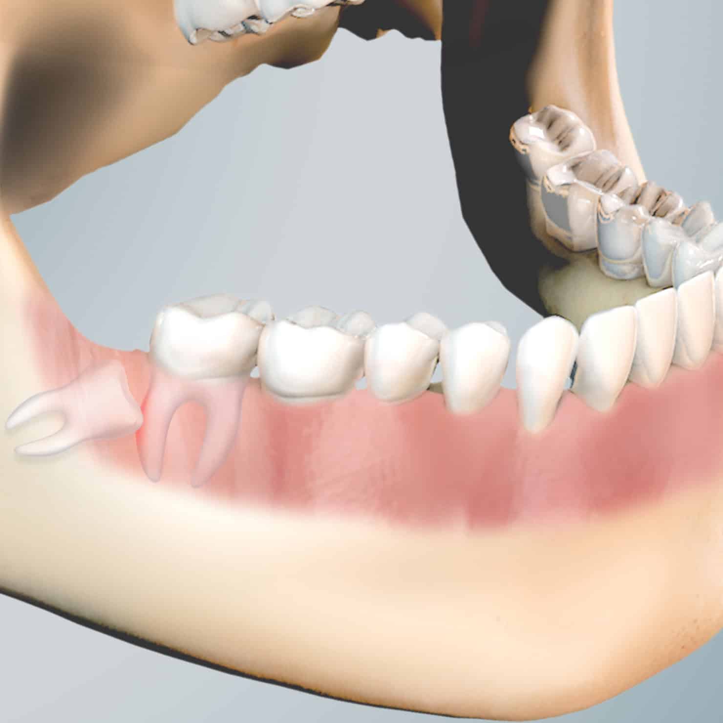 procedure